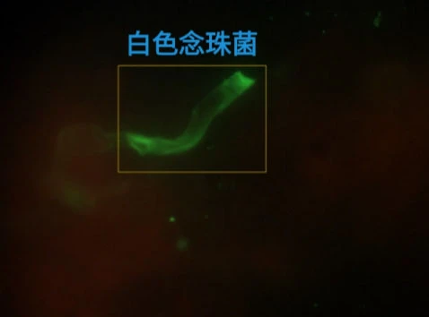 微生物白色念珠菌识别