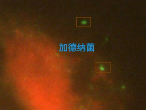 微生物加微病菌识别