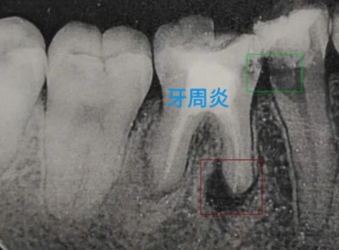 口腔X光片病症识别